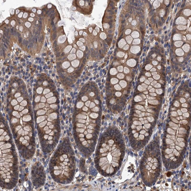 LRRC2 Antibody in Immunohistochemistry (Paraffin) (IHC (P))