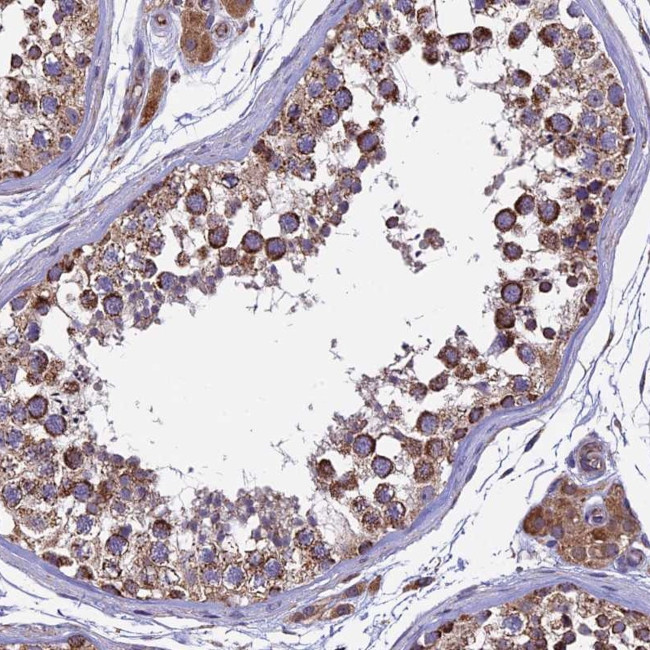 RNF17 Antibody in Immunohistochemistry (Paraffin) (IHC (P))