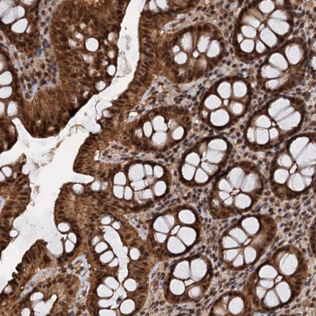 C13orf30 Antibody in Immunohistochemistry (Paraffin) (IHC (P))