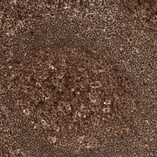 C11orf84 Antibody in Immunohistochemistry (Paraffin) (IHC (P))