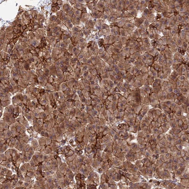 HOMER2 Antibody in Immunohistochemistry (Paraffin) (IHC (P))