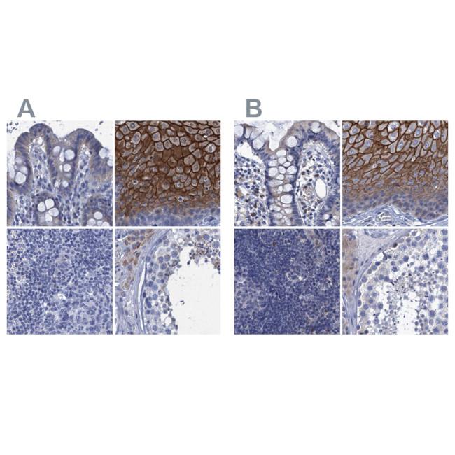 SCEL Antibody in Immunohistochemistry (IHC)