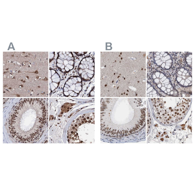 CSTF3 Antibody in Immunohistochemistry (IHC)