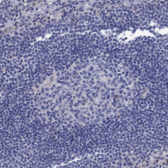 SPON2 Antibody in Immunohistochemistry (Paraffin) (IHC (P))