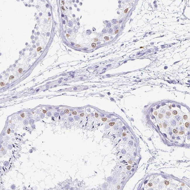 TPSD1 Antibody in Immunohistochemistry (Paraffin) (IHC (P))