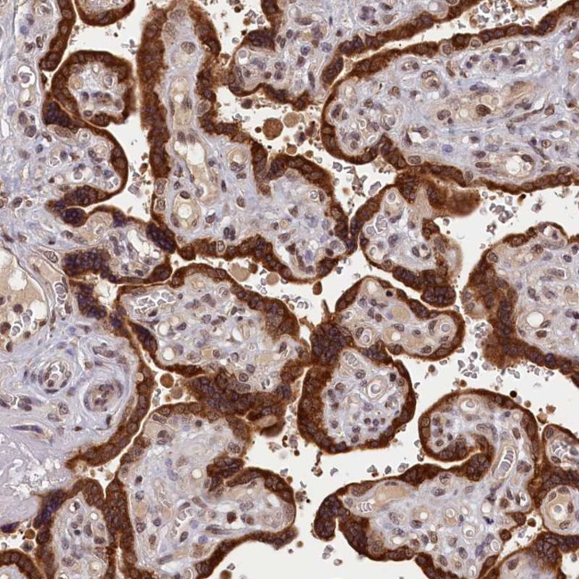 KCNK6 Antibody in Immunohistochemistry (Paraffin) (IHC (P))