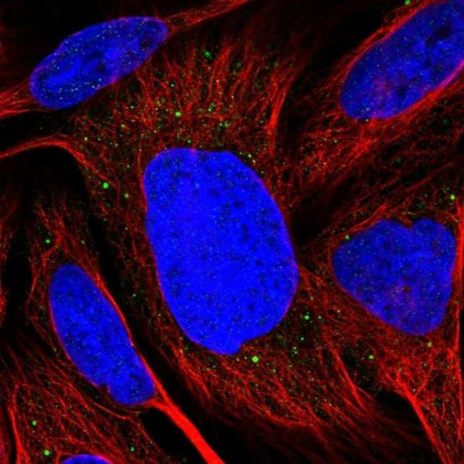 TMEM39B Antibody in Immunocytochemistry (ICC/IF)