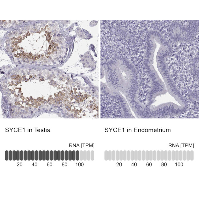 SYCE1 Antibody in Immunohistochemistry (IHC)