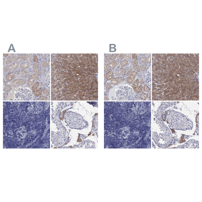 AOX1 Antibody in Immunohistochemistry (Paraffin) (IHC (P))