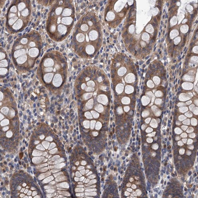 TMEM39B Antibody in Immunohistochemistry (Paraffin) (IHC (P))