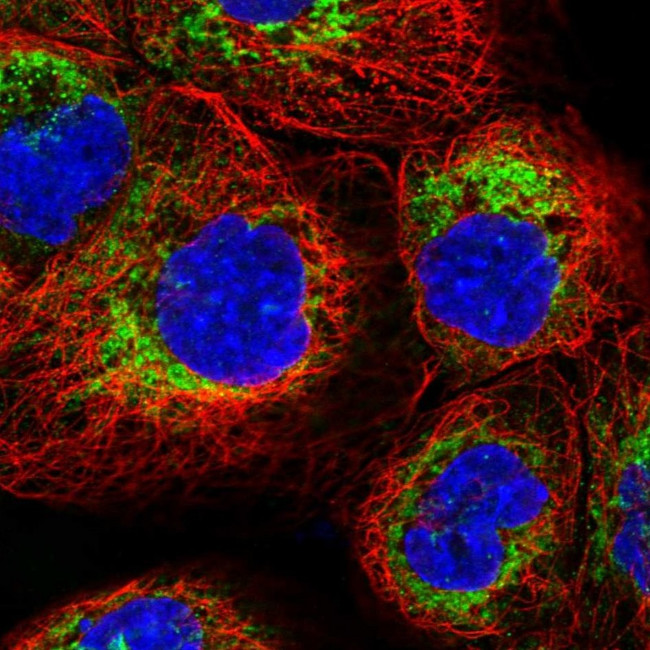 TMEM18 Antibody in Immunocytochemistry (ICC/IF)