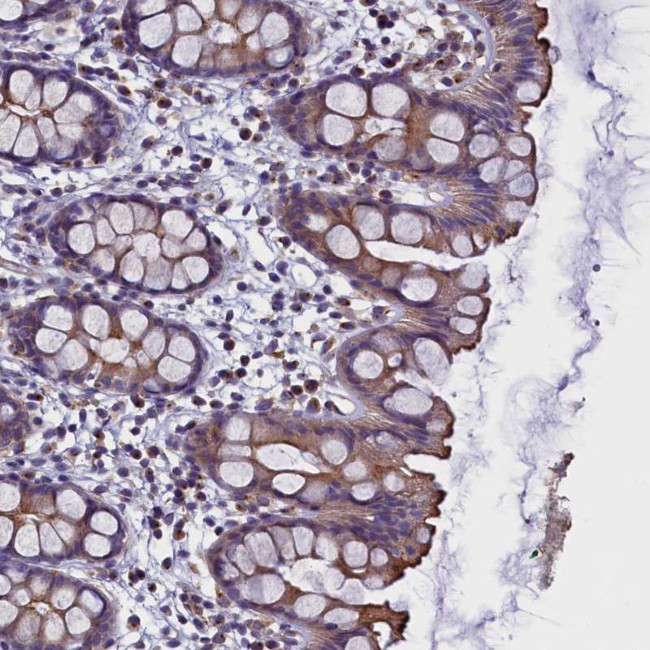 STK32A Antibody in Immunohistochemistry (Paraffin) (IHC (P))