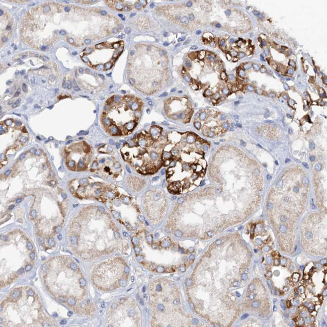 MRPL48 Antibody in Immunohistochemistry (Paraffin) (IHC (P))