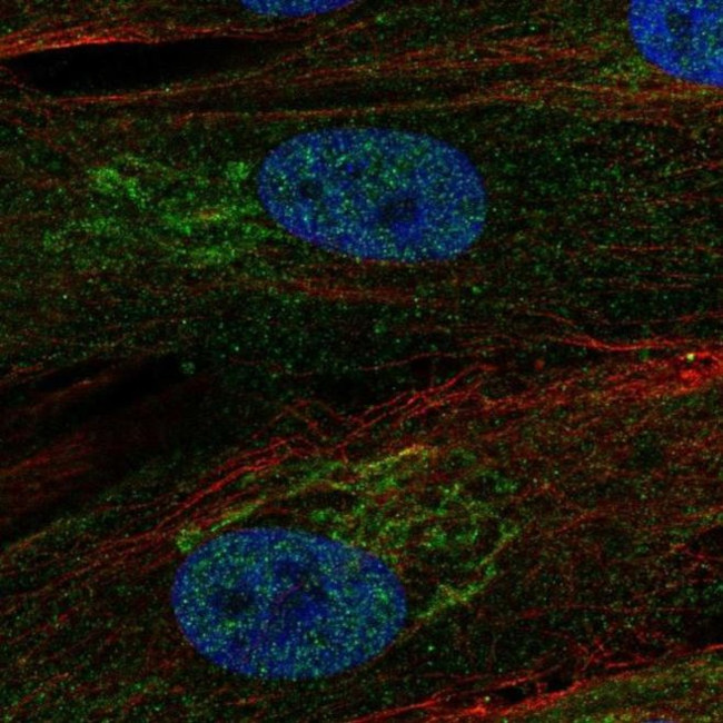 RCBTB2 Antibody in Immunocytochemistry (ICC/IF)