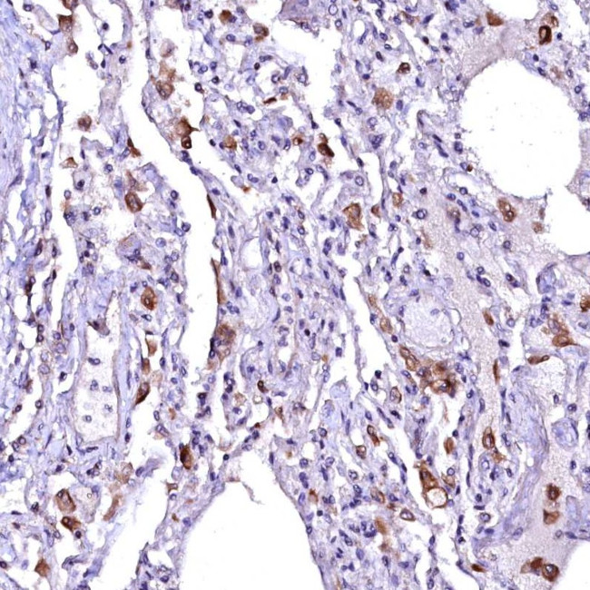 OVCH1 Antibody in Immunohistochemistry (Paraffin) (IHC (P))