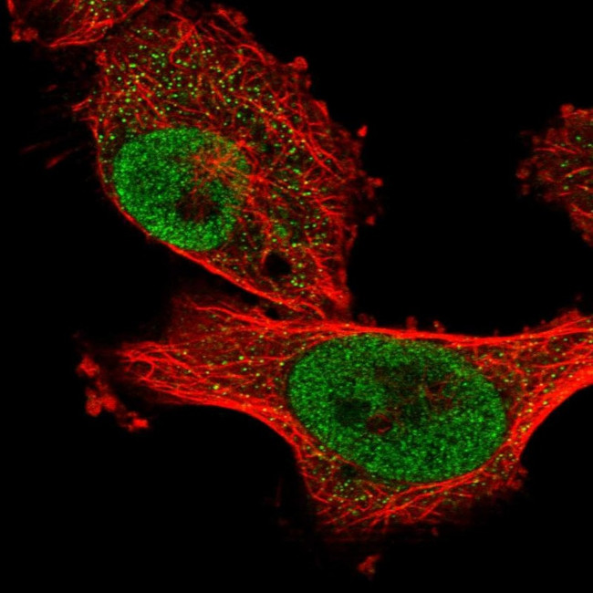 ANR49 Antibody in Immunocytochemistry (ICC/IF)