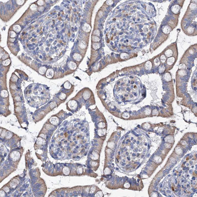 TMX2 Antibody in Immunohistochemistry (Paraffin) (IHC (P))