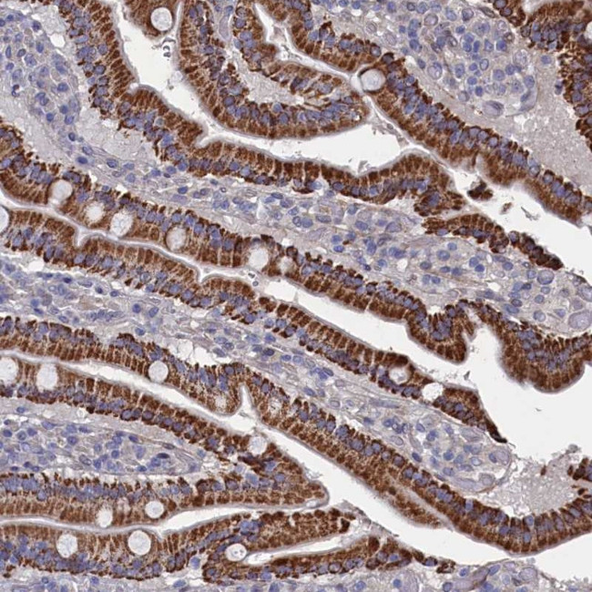 ZNF891 Antibody in Immunohistochemistry (Paraffin) (IHC (P))