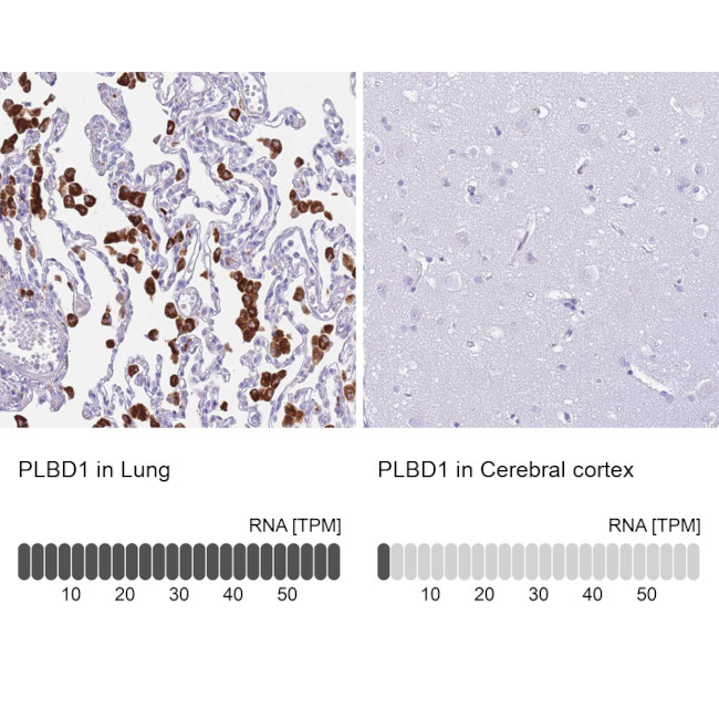 PLBD1 Antibody in Immunohistochemistry (IHC)