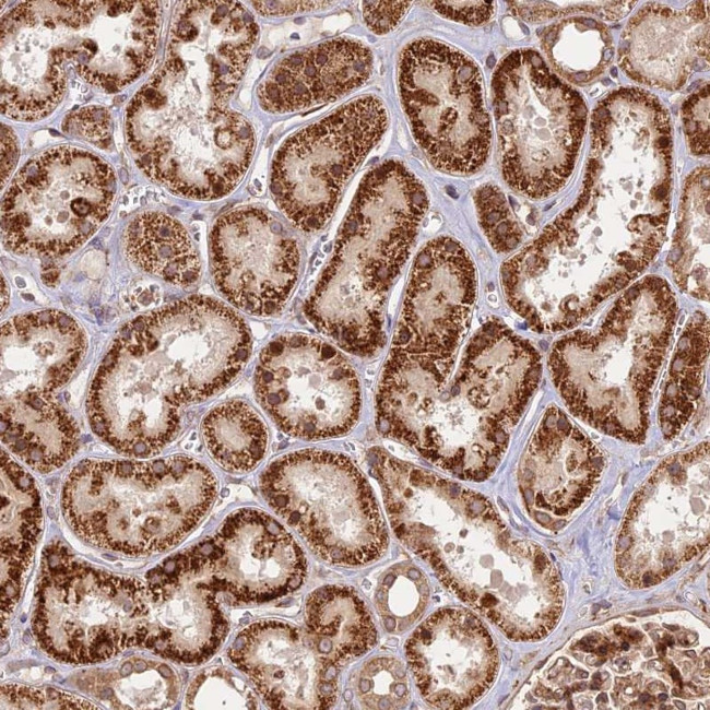 DGKH Antibody in Immunohistochemistry (Paraffin) (IHC (P))