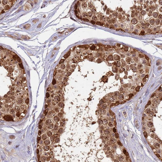 RAPGEF3 Antibody in Immunohistochemistry (Paraffin) (IHC (P))