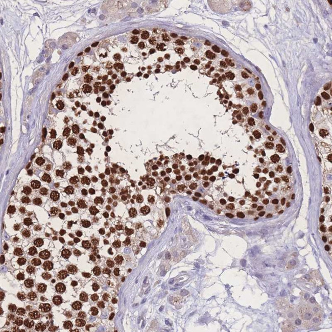 ZNF662 Antibody in Immunohistochemistry (Paraffin) (IHC (P))