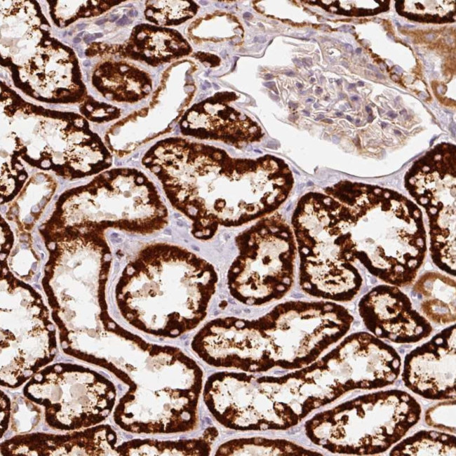 ARHGAP22 Antibody in Immunohistochemistry (Paraffin) (IHC (P))