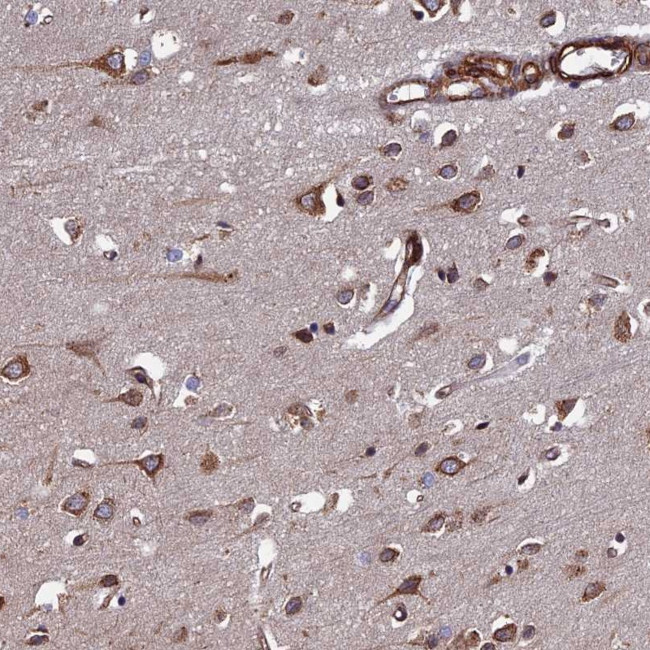 FCP1 Antibody in Immunohistochemistry (Paraffin) (IHC (P))