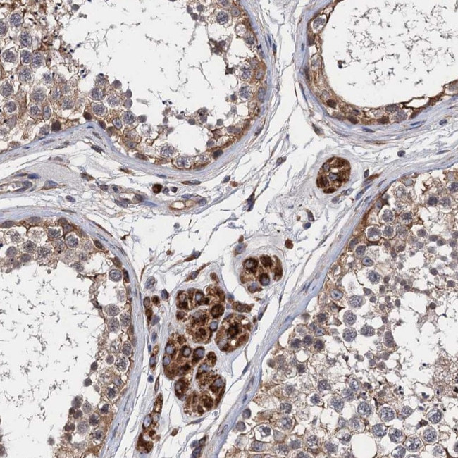 CNNM1 Antibody in Immunohistochemistry (Paraffin) (IHC (P))