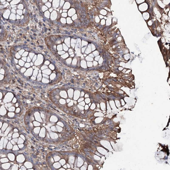 COG6 Antibody in Immunohistochemistry (Paraffin) (IHC (P))