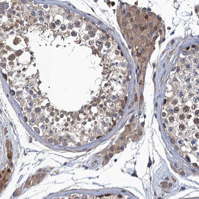 MDM1 Antibody in Immunohistochemistry (IHC)