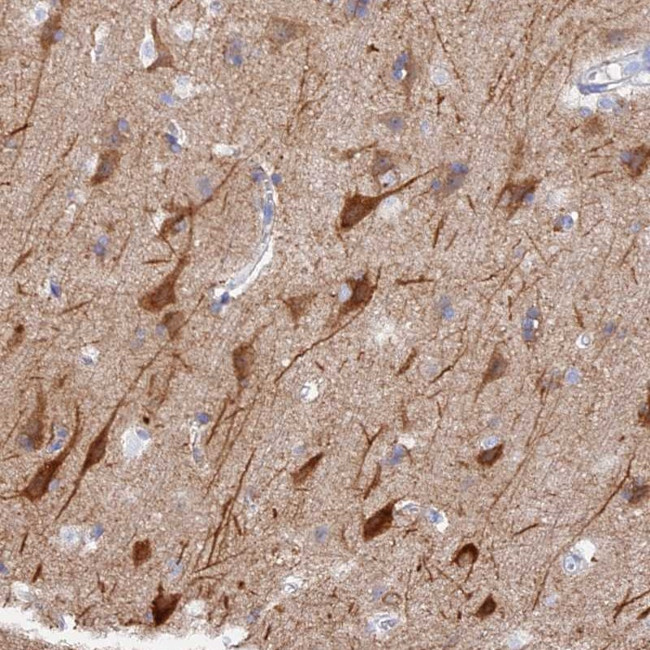 VPS33B Antibody in Immunohistochemistry (Paraffin) (IHC (P))