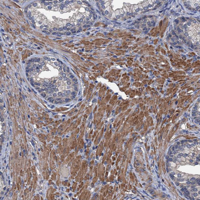 ARHGAP11A Antibody in Immunohistochemistry (IHC)