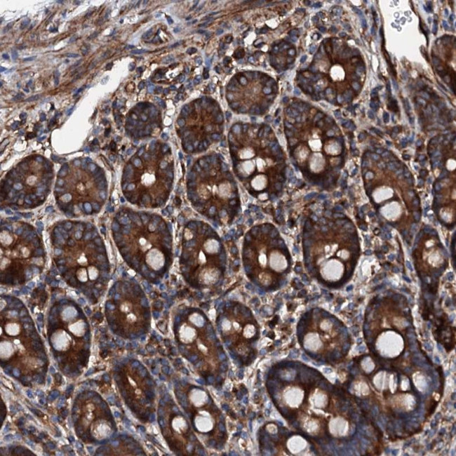 MOS Antibody in Immunohistochemistry (Paraffin) (IHC (P))
