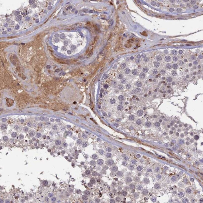 ADO Antibody in Immunohistochemistry (IHC)