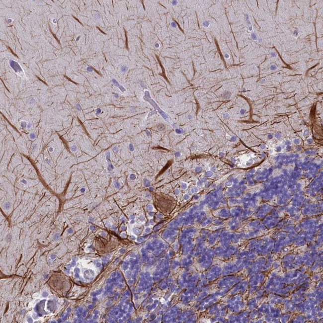 SKIDA1 Antibody in Immunohistochemistry (Paraffin) (IHC (P))