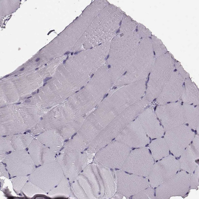 Cystatin F Antibody in Immunohistochemistry (Paraffin) (IHC (P))