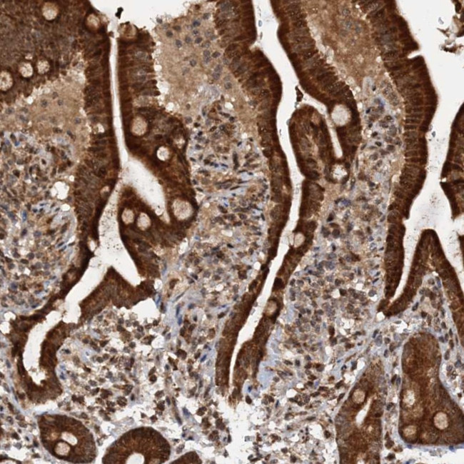 REP15 Antibody in Immunohistochemistry (Paraffin) (IHC (P))