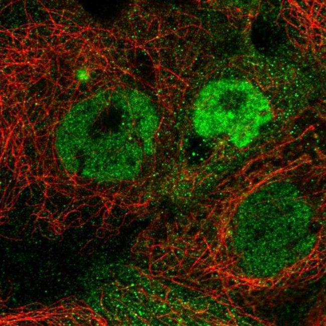 TMEM98 Antibody in Immunocytochemistry (ICC/IF)