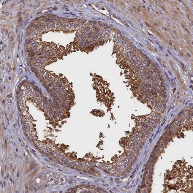 RBFA Antibody in Immunohistochemistry (Paraffin) (IHC (P))