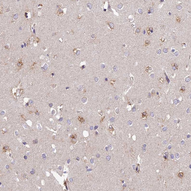 ARL8A Antibody in Immunohistochemistry (Paraffin) (IHC (P))