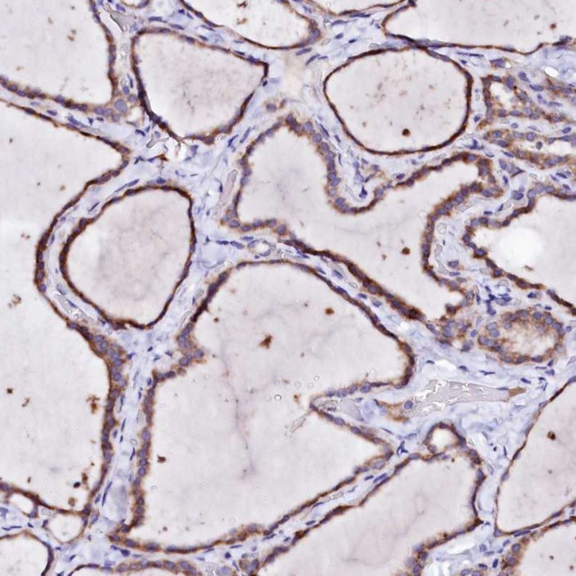BTBD16 Antibody in Immunohistochemistry (Paraffin) (IHC (P))
