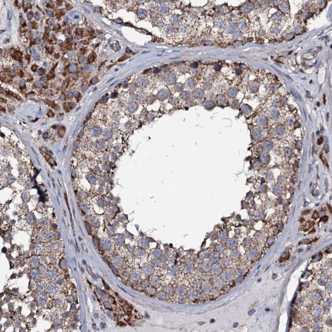 NRIP3 Antibody in Immunohistochemistry (Paraffin) (IHC (P))