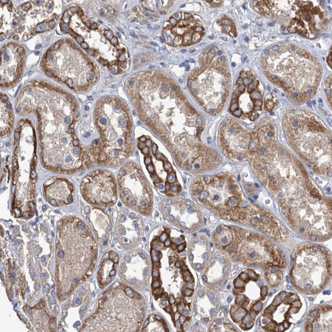 SMCO3 Antibody in Immunohistochemistry (Paraffin) (IHC (P))