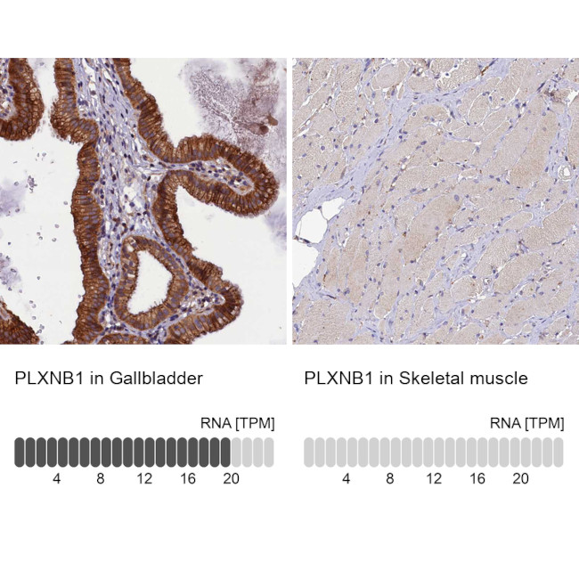 PLXNB1 Antibody in Immunohistochemistry (IHC)