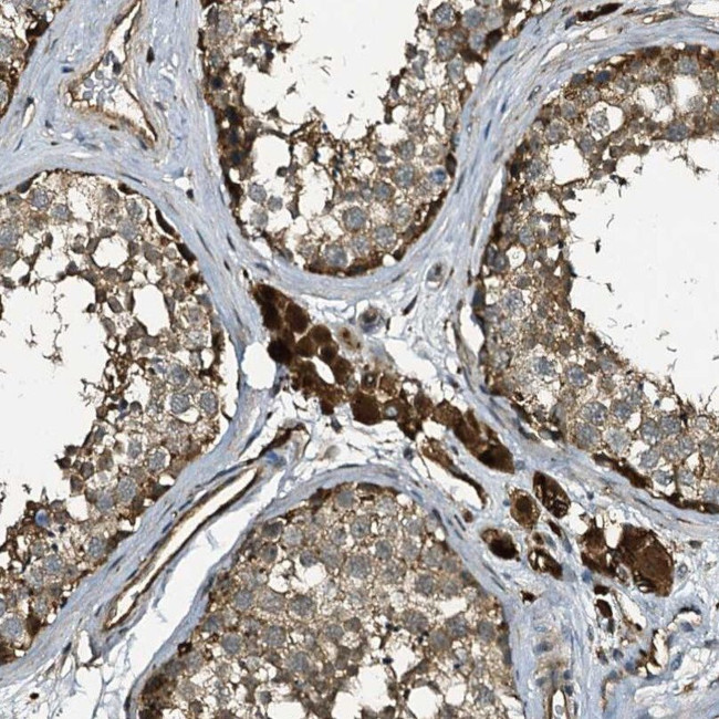 TPGS2 Antibody in Immunohistochemistry (IHC)