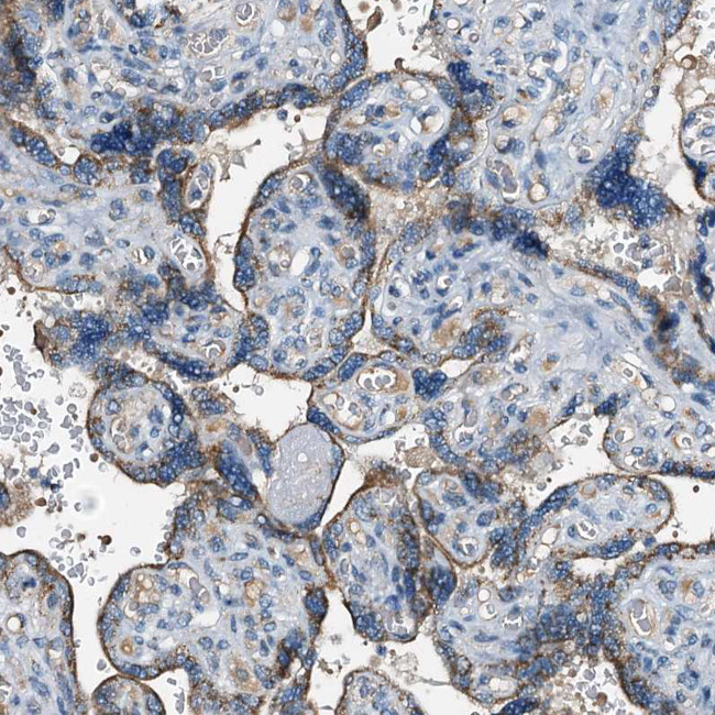 POC1A Antibody in Immunohistochemistry (Paraffin) (IHC (P))