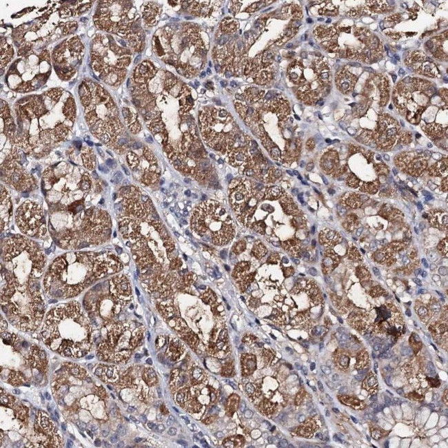 PPTC7 Antibody in Immunohistochemistry (IHC)
