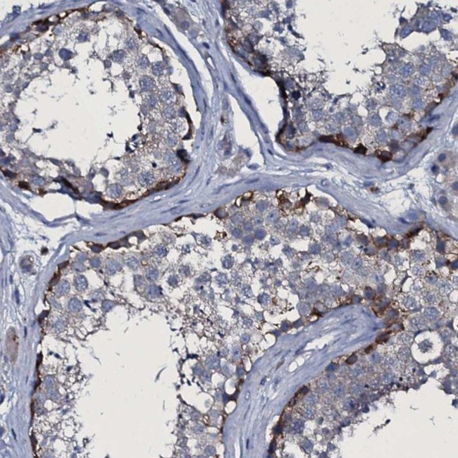 TPGS2 Antibody in Immunohistochemistry (IHC)