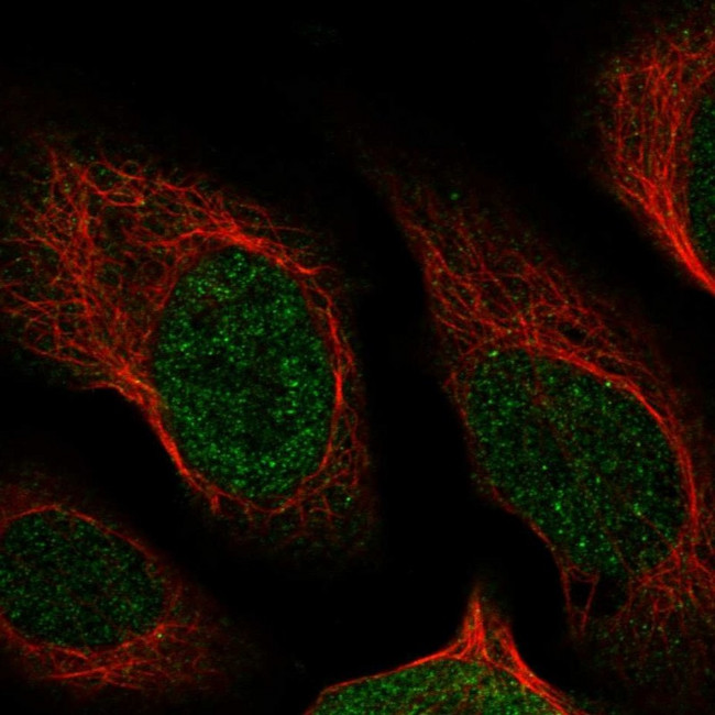 NUDT13 Antibody in Immunocytochemistry (ICC/IF)